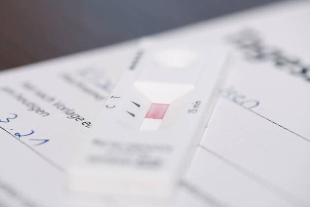 Coronavirus in Tübingen, Corona-Teststation auf dem Gelände der CeGat GmbH
