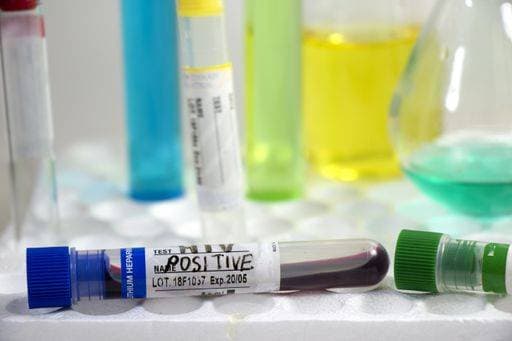 Welt-Aids-Impfstofftag am 18. Mai