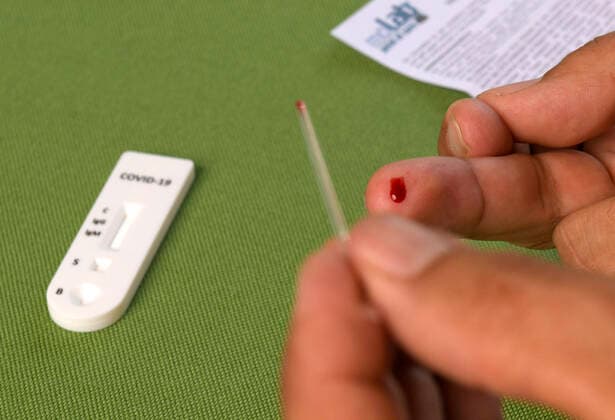 Bayern will Coronavirus-Tests ausweiten, Symbolfotos