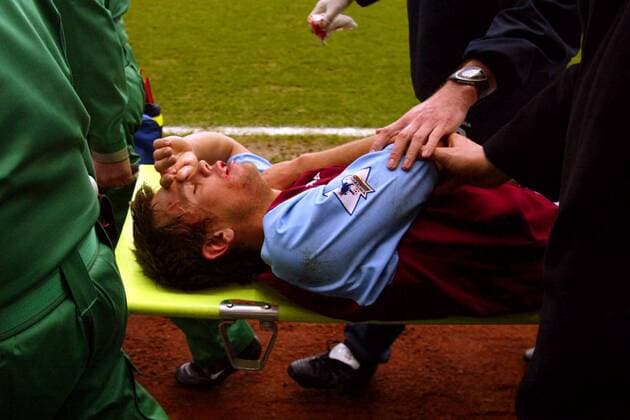Lee Hendrie (Aston Villa) wird mit einer Platzwunde an der Lippe vom Platz getragen Fußball Herren FA-Cup 2003 2004, englischer Pokal, Pokalspiel, Aston Villa FC, Einzelbild Birmingham