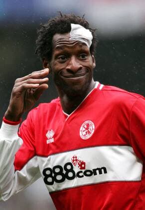 Ugo Ehiogu (Middlesbrough) macht Fratzen trotz Kopfverletzung -  Fußball Herren English Premier League 2005 2006, 1. Englische Liga, FC Middlesbrough Einzelbild Manchester Komik,
