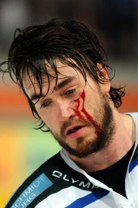 Justin Kelly (Bietigheim Bissingen) mit einer Platzwunde Eishockey 2. BL Herren Saison 2008 2009, SC Bietigheim Bissingen Steelers Porträt Playoffs, Playoff, Play Offs, Off, Finale München