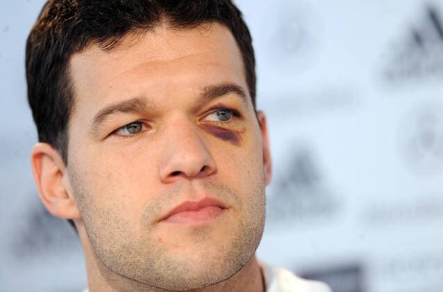 Fussball International, Deutsche Nationalmannschaft Deutscher Fussballbund, DFB 02.03.2010: Michael Ballack (GER)  o0 blaues Auge Veilchen