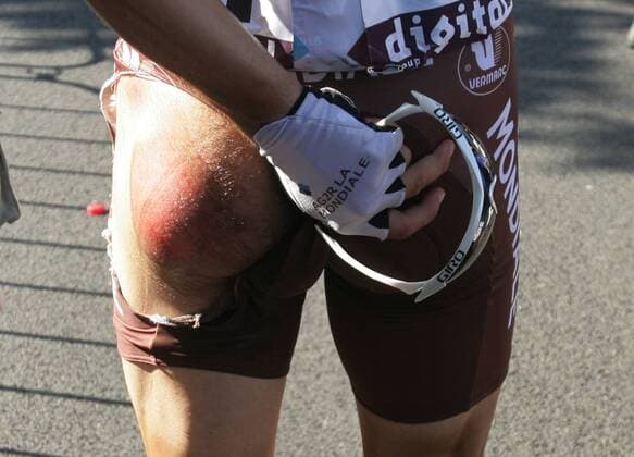 04.07.2010 Brüssel Radsport 97. Tour de France 2010, 1. Etappe Rotterdam-Bruxelles, Lloyd Mondory (FRA AG2R) nach einem Sturz o0 zerrissen Schürfwunde Wunde Po Gesäß Hintern Symbol