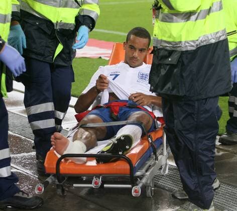 England s Theo Walcott goes off injured European Championship Qualifying Group G Switzerland v England 7th September, 2010 EDITORIAL USE ONLY. No use with unauthorised audio, video, data, fixture lists, club league logos or live services. Online in-match use limited to 120 images, no video emulation. No use in betting, games or single club league player publications.