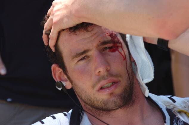 Tour Down Under 2011 - 2. Etappe - Tailem Bend - Mannum - Mark Cavendish (Htc - High Road) verletzt - 