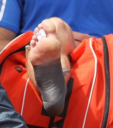 Andy Murray of Great Britain has his ankle taped after twisting it during his French Open mens third round match at Roland Garros in Paris on May 28, 2011. Murray defeated Berrer 6-3, 6-2, 6-3 to advance to the fourth round.  PAR20110528712 o0 Andrew Verletzung, Körperteile Fuß