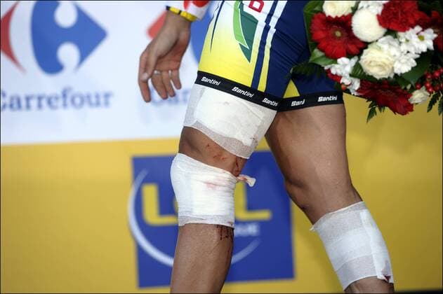 Johnny Hoogerland ( BEL Vacansoleil ) 9. Etappe: Issoire - Saint Flour - 10.07.2011 - xPhotoNewsx  o0 Verletzung bluten Blut blutig Verband Bandage bandagiert Bein Beine Körperteile Siegerehrung