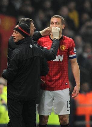 Nemanja Vidic of Manchester United receives treatment during the game - FA Cup 5th Round - Manchester Utd vs Reading - Old Trafford Stadium - Manchester - 18 02 13 - Picture Simon Bellis Sportimage EDITORIAL USE ONLY. No use with unauthorised audio, video, data, fixture lists, club league logos or live services. Online in-match use limited to 120 images, no video emulation. No use in betting, games or single club league player publications.