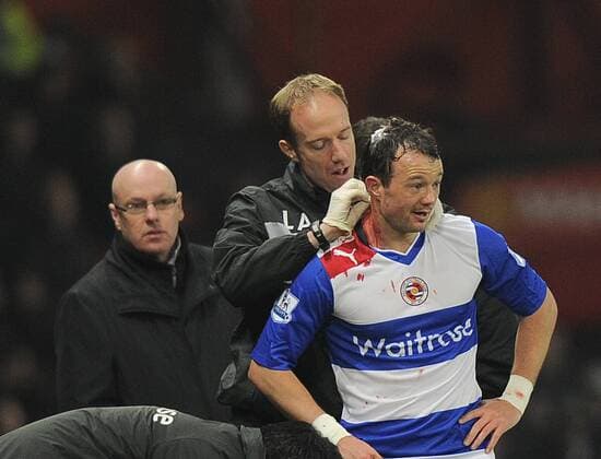 Noel Hunt of Reading receives treatment for a cut on his head while Brian McDermott manager of Reading looks on - FA Cup 5th Round - Manchester Utd vs Reading - Old Trafford Stadium - Manchester - 18 02 13 - Picture Simon Bellis Sportimage EDITORIAL USE ONLY. No use with unauthorised audio, video, data, fixture lists, club league logos or live services. Online in-match use limited to 120 images, no video emulation. No use in betting, games or single club league player publications.