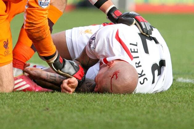 Football - 2013 2014 FA Cup - Fourth Round: AFC Bournemouth vs. FC Liverpool Martin Skrtel of Liverpool lies in the penalty area with a head wound at Dean Court The Goldsands Stadium - 
