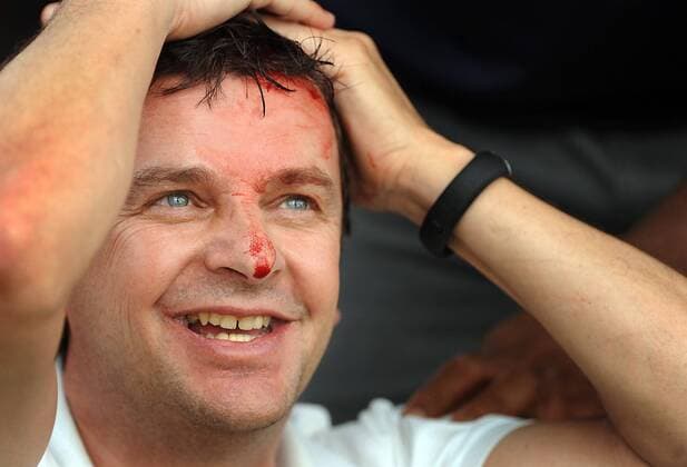 March 9, 2014 - Doral, FL, USA - This unlucky fan was hit on the head by Tiger Woods tee shot in the final round of the WGC-Cadillac Championship at Trump National Doral on Sunday, March 9, 2014, in Doral, Fla. WGC-Cadillac Championship - ZUMAm67