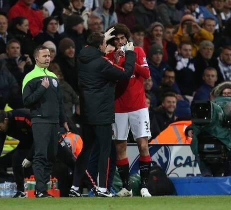 Manchester United ManU s Marouane Fellaini gets a bang on the nose FA Cup - Preston North End vs Manchester United - Deepdale - England - 16th February 2015 - Picture David Klein Sportimage EDITORIAL USE ONLY. No use with unauthorised audio, video, data, fixture lists, club league logos or live services. Online in-match use limited to 120 images, no video emulation. No use in betting, games or single club league player publications.