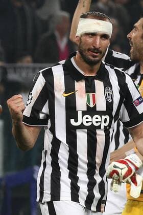 Aktuell Fußball, Champions League, Giorgio Chiellini von Juventus Turin spielt nach Verletzung mit Kopfverband weiter May 5, 2015 - Turin, Italy - Juventus defender Giorgio Chiellini (3) celebrates victory after the Uefa Champions League semi finals football match JUVENTUS - REAL MADRID on 05 05 15 at the Juventus Stadium in Turin, Italy. Copyright 2015 Matteo Bottanelli Juventus v Real Madrid CF - UEFA Champions League Semi Final  - ZUMAn230