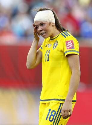 (150613) -- WINNIPEG, June 12, 2015 -- Jessica Samuelsson of Sweden gets injured on her head during a Group D match between the United States and Sweden at Winnipeg Stadium in Winnipeg, Canada on June 12, 2015. The match ended 0-0. ) (SP)CANADA-WINNIPEG-FIFA-WOMEN S WORLD CUP-USA VS SWE DingxXu 