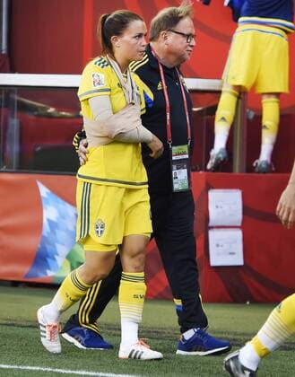 Aktuell Fußball, Damen WM in Kanada, USA - Schweden June 12, 2015 - Winnipeg, Kanada - 150612 - Emilia Appelqvist har armen i bandage - mitella. Bredvid lÃƒÂ¤kare Yelverton Tegner WM - USA - SWE - ..Foto: CarlSandin BILDBYRAN kod CS 57685 News - June 12, 2015  - ZUMAb138