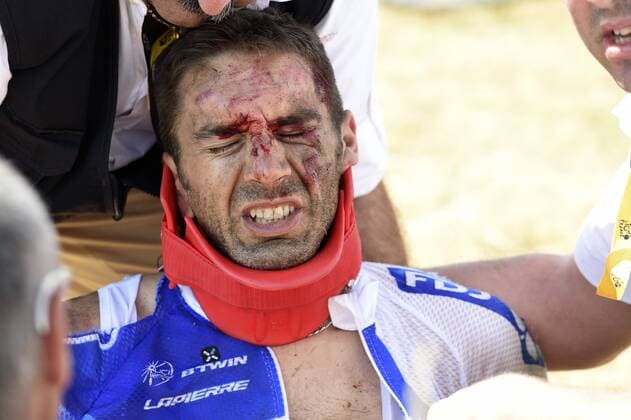 BONNET William of FDJ, victim of the crash during the stage 3 of the 102nd edition of the Tour de France 2015 with start in Antwerp and finish in Huy, Belgium (159 kms) CYCLISME : Tour de France - Etape 3 - Anvers Huy - 06 07 2015 PhotoNews Panoramic 