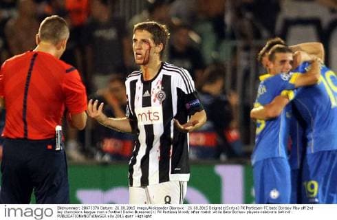26.08.2015 Belgrade(Serbia) FK Partizsan-FC bate Borisov Play off 2nd leg champions league men s football Darko Brasanac(c) FK Partizan bloody after match while Bate Borisov players celebrate behind : 