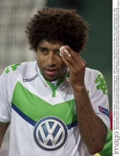 DANTE (VfL) mit einer Platzwunde am linken Auge. Fussball international: UEFA Championsleague Saison 2015 2016, Gruppenspiel: VfL Wolfsburg - PSV Eindhoven in Wolfsburg, Deutschland am 21.10.2015,
