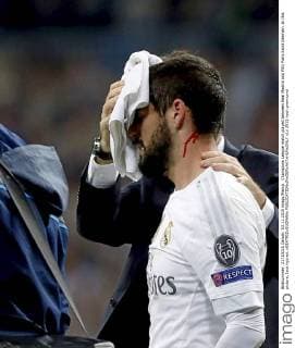 Champions League match played between Real Madrid and PSG Paris Saint Germain. In this picture, Isco injured. xBEATRIZxGUZMANx 