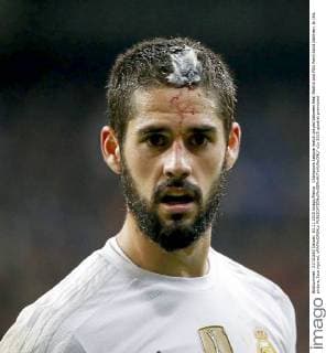 Champions League match played between Real Madrid and PSG Paris Saint Germain. In this picture, Isco injured. xRAFAxCASALx 