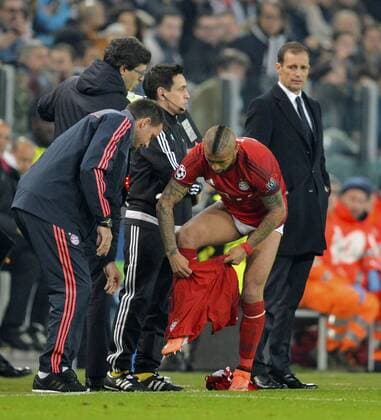 Fußball, Champions League, Juventus Turin - FC Bayern München 23.02.2016, Fussball Championsleague 2015 2016, Achtelfinale, Juventus Turin - FC Bayern München, in der Juventus Arena, Turin (Italien). Arturo Vidal (FC Bayern München) wechselt während des Spieles seine Hose. 