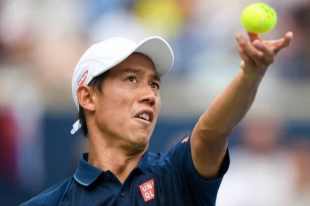 July 31, 2016: Kei Nishikori of Japan serves the ball to Novak Djokovic of Serbia & Montenegro during the Rogers Cup tournament final at the Aviva Centre in Toronto, Ontario, Canada on July 31, 2016. Cal Media TENNIS 2016 - Rogers Cup Toronto Final July 31 - ZUMAc04_