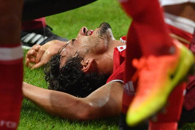 Mats HUMMELS (Bayern Muenchen) nach Schlag auf den Kiefer,verletzt,Verletzung, FC Bayern Muenchen-FK Rostow, Fussball Champions League Gruppenphase am 13.09.2016. A L L I A N Z A R E N A.