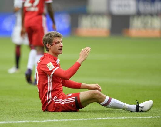 Bilder des Tages - SPORT 15.10.2016, Fussball 1.Bundesliga 2016 2017, 7.Spieltag, Eintracht Frankfurt - FC Bayern München, in der Commerzbank-Arena Frankfurt Main. Nach einem Zweikampf Blutet Thomas Müller (FC Bayern München) aus einer Wunde über dem Auge stark. 