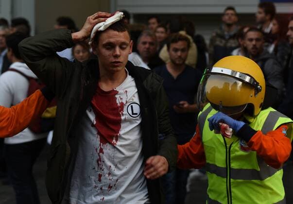 Themen der Woche - Sport Bilder des Tages - SPORT Fußball, CL, Real Madrid - Legia Warschau, Ausschreitungen vor dem Spiel Spanish riot police charge Legia fans in Madrid Members of the specialized emergency system in Madrid help a wounded Legia fan during clashes with Spanish riot police in Madrid.  JorgexSanzx xPacificxPress