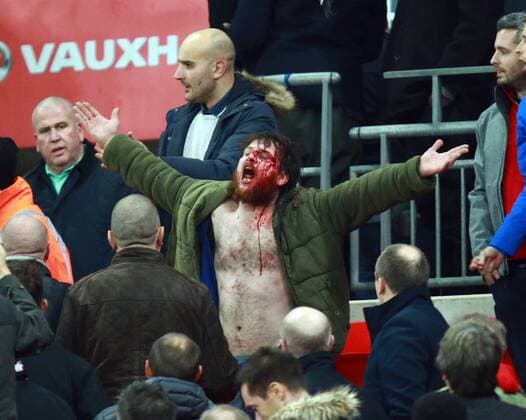 England v Scotland - FIFA World Cup WM Weltmeisterschaft Fussball 2018 Qualifier . . London, UK . . 11.11.2016 Fighting broke out amongst some England supporters, leaving one man covered in blood. 
