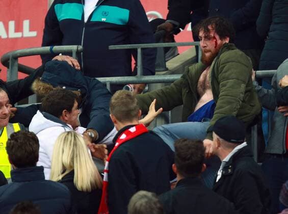 England v Scotland - FIFA World Cup WM Weltmeisterschaft Fussball 2018 Qualifier . . London, UK . . 11.11.2016 Fighting broke out amongst some England supporters, leaving one man covered in blood. 