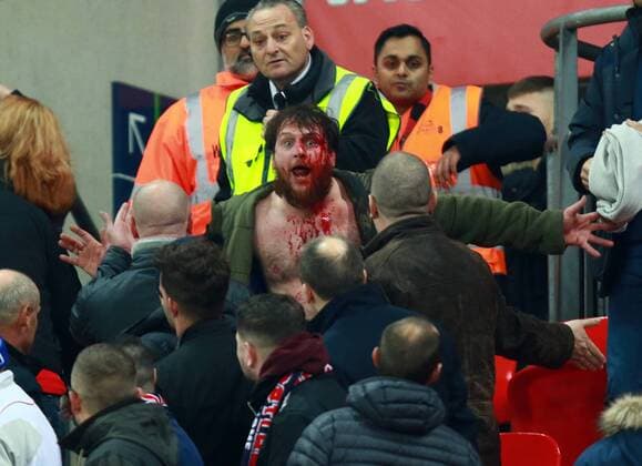England v Scotland - FIFA World Cup WM Weltmeisterschaft Fussball 2018 Qualifier . . London, UK . . 11.11.2016 Fighting broke out amongst some England supporters, leaving one man covered in blood. 