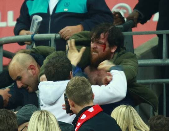 England v Scotland - FIFA World Cup WM Weltmeisterschaft Fussball 2018 Qualifier . . London, UK . . 11.11.2016 Fighting broke out amongst some England supporters, leaving one man covered in blood. 