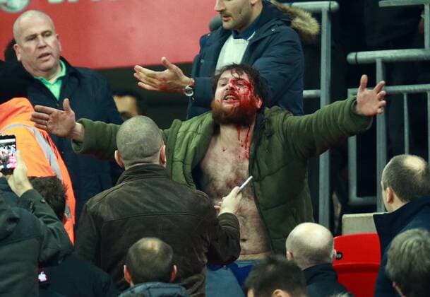 Bilder des Tages - SPORT England v Scotland - FIFA World Cup WM Weltmeisterschaft Fussball 2018 Qualifier . . London, UK . . 11.11.2016 Fighting broke out amongst some England supporters, leaving one man covered in blood. 