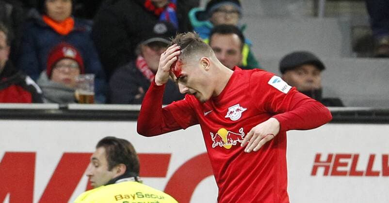 Leverkusen, Bayarena, 18.11.16: Marcel Sabitzer (RB Leipzig) mit einer Platzwunde und viel Blut nach einem Zweikampf mit Wendell (Bayer 04 Leverkusen) im Spiel der 1. Bundesliga zwischen Bayer 04 Leverkusen vs. RB Leipzig in der Saison 2016 2017.