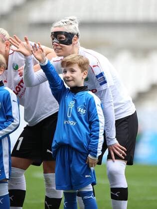 19.03.2017 xcex Deutschland, Essen, Frankfurt, Fussball, Frauenfussball Allianz Frauen-Bundesliga Saison 2016 2017 Sophie Schmidt (Frankfurt) spielt nach Jochbeinbruch mit einer Gesichtsmaske