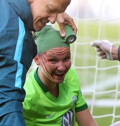 Themen der Woche - SPORT Bilder des Tages - SPORT VfL vs Essen, Frauen Wolfsburg, Deutschland. 10.05.2017, FUßBALL - VfL Wolfsburg vs SGS Essen, 1. Allianz Frauen Bundesliga, Saison 2016-17. Bild zeigt: Alexandra Popp (VfL Wolfsburg) liegt verletzt am Boden, wurde behandelt Wolfsburg