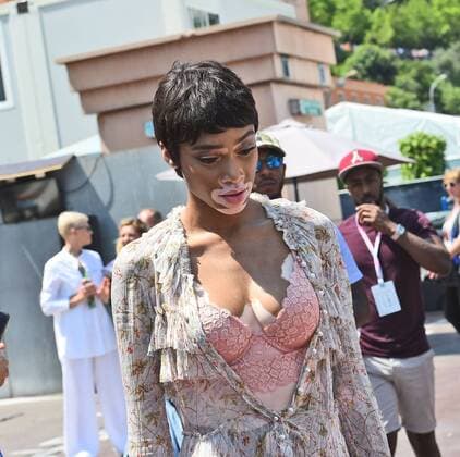 Winnie Harlow (Model), Grosser Preis von Monaco 2017, Motorsport, Formel 1, Rennen, 28.05.2017, Monte Carlo Copyright: xAndre Eibner-Pressefotox EP_JAE
