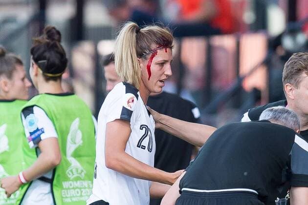IMAGO Iconic Moments, Fußball - Frauen Bilder des Tages - SPORT Deventer, Niederlande 18.07.2017, UEFA Frauen-EM, 2017, women s Euro 2017, Gruppe C, Oesterreich - Schweiz, Lisa Makas (AUT) verletzt ( DeFodi001