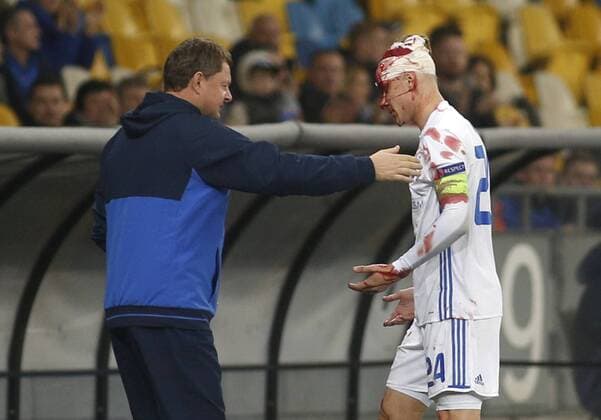 Bilder des Tages - SPORT October 19, 2017 - Coach thanks to injured Domagoj Vida during the UEFA Europa League Group B soccer match between FC Dynamo Kyiv and FC Young Boys at the NSK Olimpiyskyi in Kyiv, Ukraine, October 19, 2017. The UEFA Europa League Group B soccer match between FC Dynamo Kyiv and FC Young Boys at the NSK Olimpiyskyi in Kyiv. - ZUMAs334 80533842st Copyright: xAnatoliixStepanovx