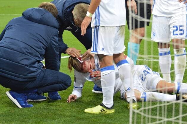 Domagoj Vida breaks his head in the match with BSC Young Boys Kyiv  Copyright: HusevxOleksandr 511086