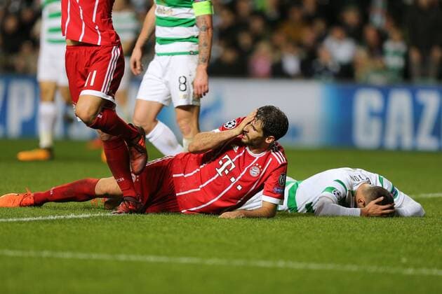 Bilder des Tages - SPORT Javi Martinez 8 (FC Bayern Muenchen) verletzt am Auge am Boden, Celtic Glasgow vs. FC Bayern Muenchen, Fussball, Vorrunde, Champions League, 31.10.2017 Glasgow Glasgow Schottland