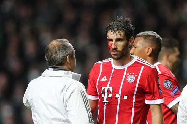 Fußball, CL, Celtic Glasgow - Bayern München, Javi Martinez erleidet Platzwunde l-r: Mannschaftsarzt Dr. Volker Braun (FC Bayern Muenchen) behandelt Javi Martinez 8 (FC Bayern Muenchen) am Auge, Blut, Celtic Glasgow vs. FC Bayern Muenchen, Fussball, Vorrunde, Champions League, 31.10.2017 Glasgow Glasgow Schottland