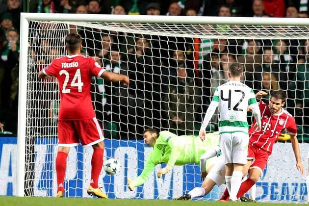 Javier Martinez (FC Bayern Muenchen 8) nach dem 1:2 mit einer Platzwunde am Kopf , Celtic Glasgow vs FC Bayern Muenchen, Champions League, Fussball, 31.10.2017, Glasgow Copyright: xLanger Eibner-Pressefotox EP_HLR