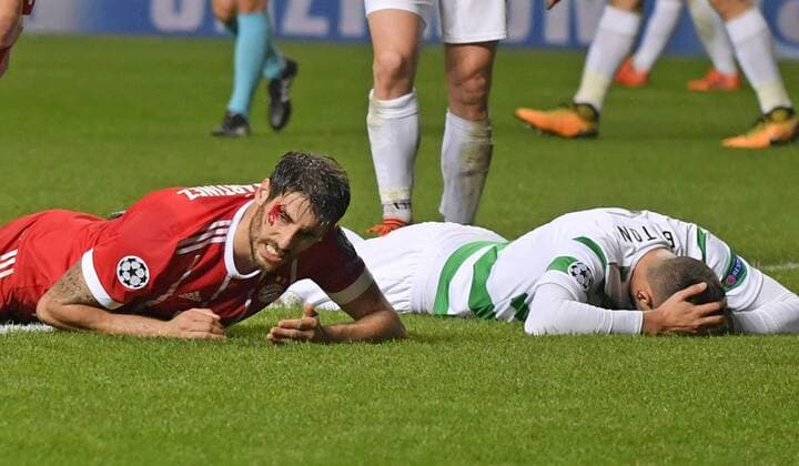 Fußball, CL, Celtic Glasgow - Bayern München, Javi Martinez erleidet Platzwunde 31.10.2017, Fussball UEFA Champions League 2017 2018, Gruppenphase, 4.Spieltag, Celtic Glasgow - FC Bayern München, im Celtic-Park Stadion Glasgow, Schottland. Nach seinem Tor zum 2:1 liegt Javi Martinez (li, FC Bayern München) mit blutender Kopfverletzung am Boden.