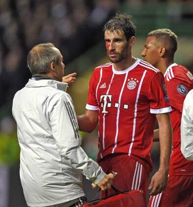 31.10.2017, Fussball UEFA Champions League 2017 2018, Gruppenphase, 4.Spieltag, Celtic Glasgow - FC Bayern München, im Celtic-Park Stadion Glasgow, Schottland. Nach seinem Tor zum 2:1 muss Javi Martinez (re, FC Bayern München) mit blutender Kopfverletzung behandelt werden.