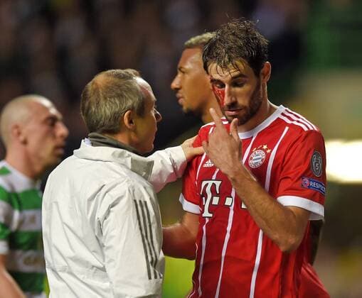 31.10.2017, Fussball UEFA Champions League 2017 2018, Gruppenphase, 4.Spieltag, Celtic Glasgow - FC Bayern München, im Celtic-Park Stadion Glasgow, Schottland. Nach seinem Tor zum 2:1 muss Javi Martinez (re, FC Bayern München) mit blutender Kopfverletzung behandelt werden.