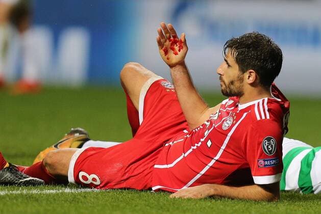 Fußball, CL, Celtic Glasgow - Bayern München, Javi Martinez erleidet Platzwunde Javi Martinez 8 (FC Bayern Muenchen) verletzt am Auge am Boden, Celtic Glasgow vs. FC Bayern Muenchen, Fussball, Vorrunde, Champions League, 31.10.2017 Glasgow Glasgow Schottland