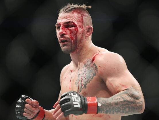 Themen der Woche - SPORT Bilder des Tages - SPORT February 24, 2018 - Orlando, FL, USA - Mike Perry bleeds profusely during UFC Fight Night at the Amway Center in Orlando, Fla., on Saturday, Feb 24, 2018. UFC Fight Night Orlando - ZUMAm67_ 20180224_zaf_m67_126 Copyright: xStephenxM.xDowellx